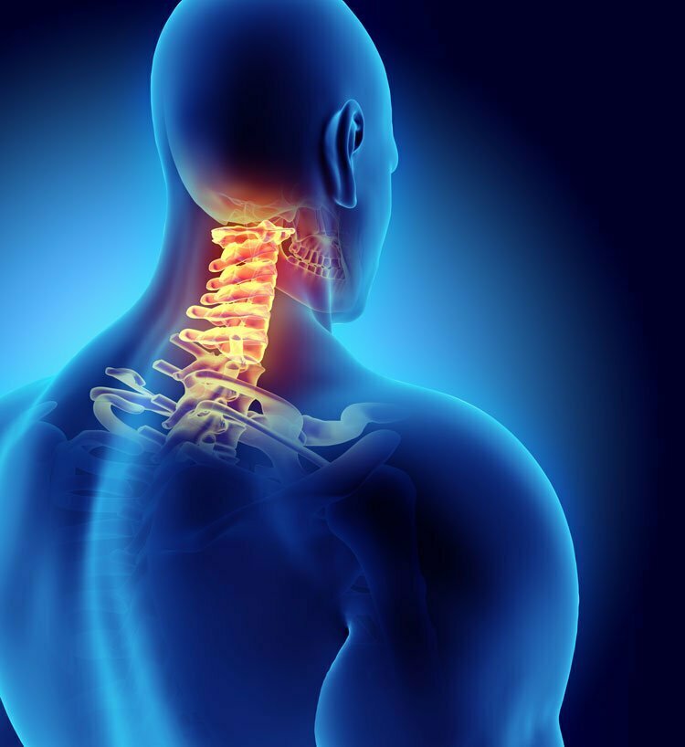 A digital illustration of a human upper body with the neck vertebrae highlighted in red and yellow, indicating pain or injury in the cervical spine